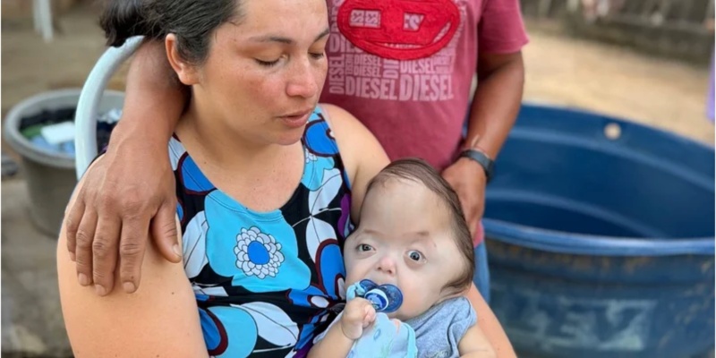 Anthony, bebê em imagem oficial da campanha de apoio às cirurgias e cuidados.